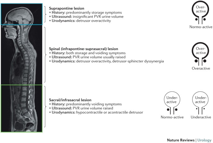 Results of Conservative and Surgical Management of the Neurogenic Bladder  in 160 Children