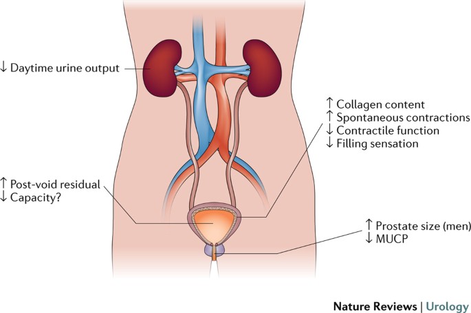 CT Woman & Child Specialist Clinic - Urge incontinence occurs when you have  a sudden urge to urinate. In urge incontinence, the urinary bladder  contracts when it shouldn't, causing some urine to