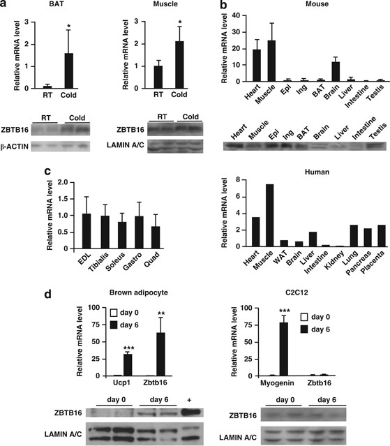 Zbtb16 has a role in brown adipocyte bioenergetics