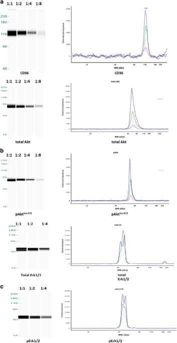 Human adipose tissue protein analyses using capillary western blot  technology | Nutrition & Diabetes