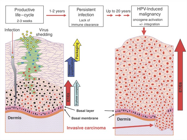 Papilloma vírus hpv hogyan kell szedni. A HPV tünetei