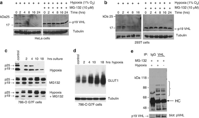 Hypoxia And Cell Cycle Regulation Of The Von Hippel Lindau Tumor Suppressor Oncogene