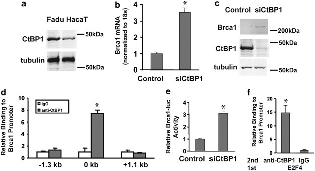 Redox-dependent brca1 transcriptional regulation by an nadh-sensor ctbp1