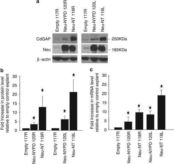 Cdgap is required for transforming growth factor β- and neu/erbb-2-induced breast cancer cell motility and invasion