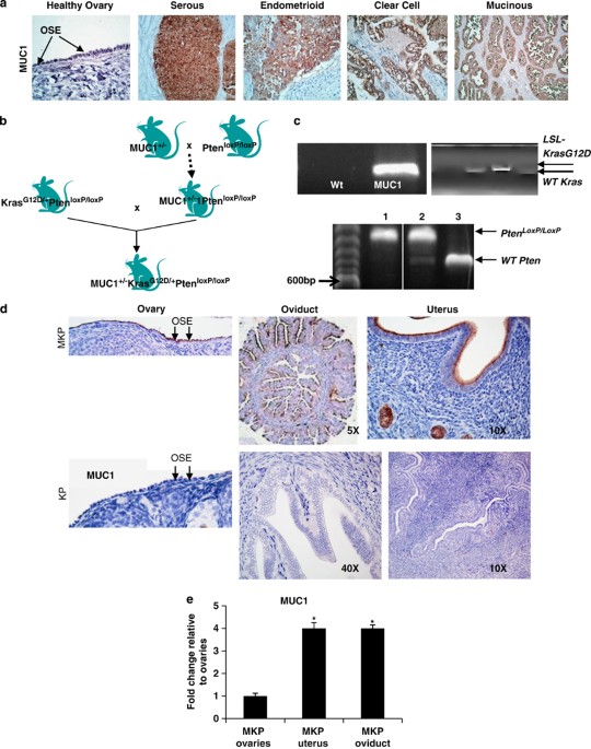 Immunobiology of human mucin 1 in a preclinical ovarian tumor model