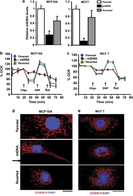 Mitochondrial Retrograde Signaling Induces Epithelial Mesenchymal Transition And Generates Breast Cancer Stem Cells Oncogene