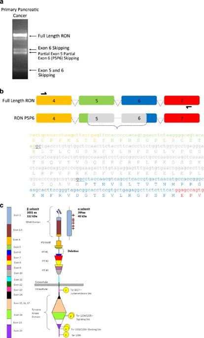 A novel protein isoform of the ron tyrosine kinase receptor transforms human pancreatic duct epithelial cells