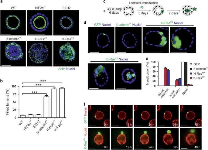 Oncogenic K Ras Upregulates Itga6 Expression Via Fosl1 To Induce Anoikis Resistance And Synergizes With Av Class Integrins To Promote Emt Oncogene