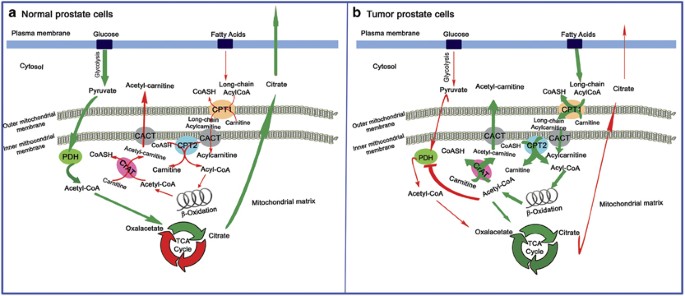 Deregulation of MicroRNAs mediated control of carnitine cycle in prostate  cancer: molecular basis and pathophysiological consequences | Oncogene