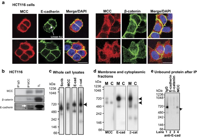 Mcc Protein Interacts With E Cadherin And B Catenin Strengthening Cell Cell Adhesion Of Hct116 Colon Cancer Cells Oncogene