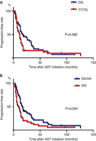 Polymorphisms of the androgen transporting gene slco2b1 may influence the castration resistance of prostate cancer and the racial differences in response to androgen deprivation
