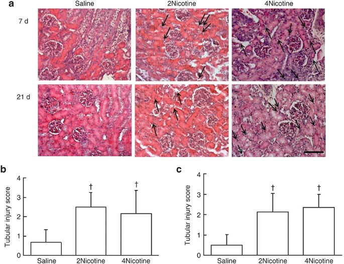 Maternal nicotine exposure during gestation and lactation induces kidney  injury and fibrosis in rat offspring