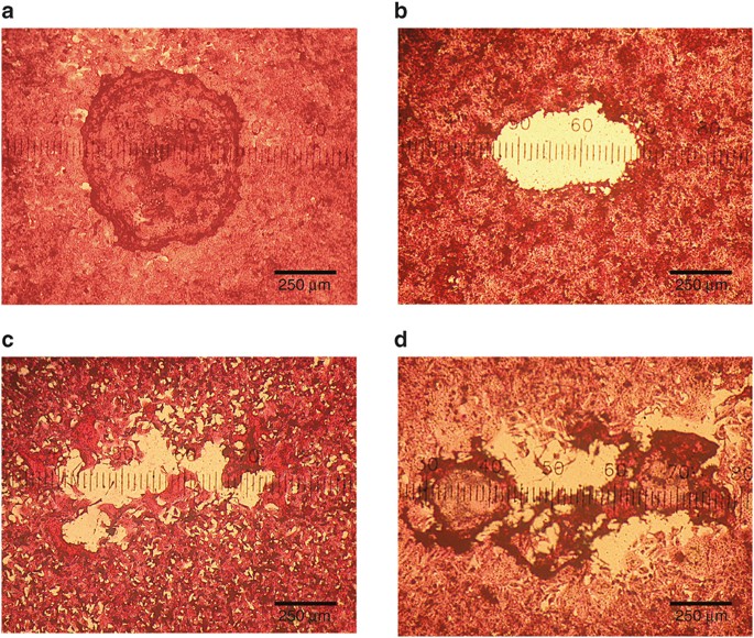 Relating plaque morphology to respiratory syncytial virus subgroup, viral load, and disease severity in children