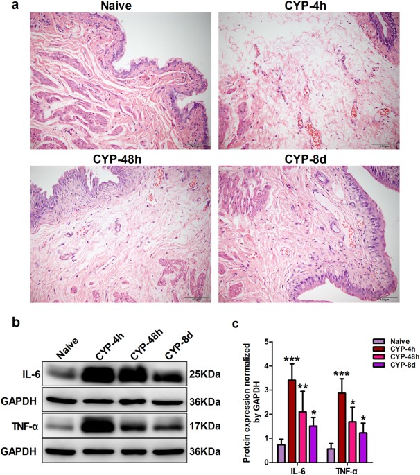 Increased piezo1 channel activity in interstitial cajal-like cells induces bladder hyperactivity by functionally interacting with ncx1 in rats with cyclophosphamide-induced cystitis