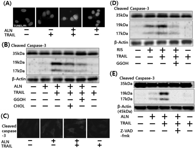 Author correction: bisphosphonate enhances trail sensitivity to human osteosarcoma cells via death receptor 5 upregulation