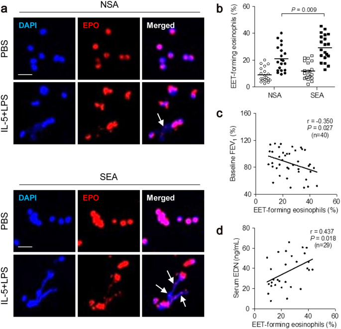 Biological Function Of Eosinophil Extracellular Traps In Patients With Severe Eosinophilic Asthma Experimental Molecular Medicine