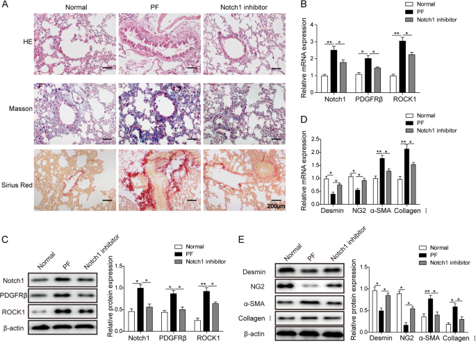 Notch1 signaling enhances collagen expression and fibrosis in