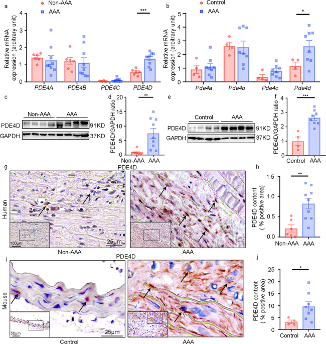 Phosphodiesterase 4d contributes to angiotensin ii-induced abdominal aortic aneurysm through smooth muscle cell apoptosis