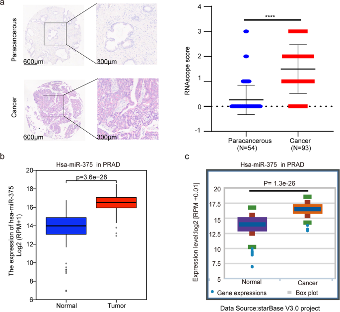 Microrna-375 is a therapeutic target for castration-resistant prostate cancer through the ptpn4/stat3 axis
