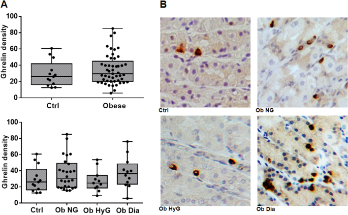 Gastric ghrelin cells in obese patients are hyperactive | International  Journal of Obesity