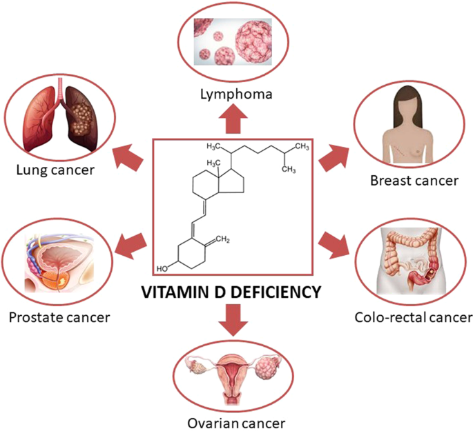 Vitamin D deficiency: a potential risk factor for cancer in obesity? |  International Journal of Obesity