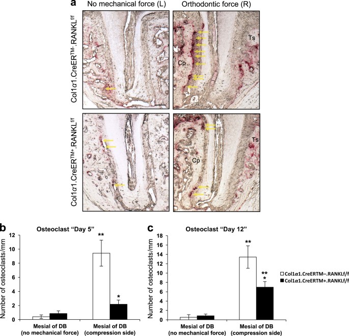 RANKL deletion in periodontal ligament and bone lining cells blocks