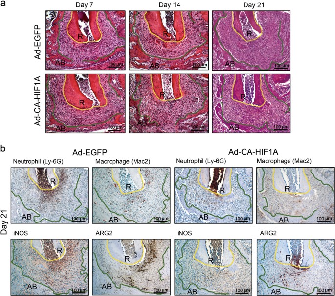Activation of hypoxia-inducible factor 1 attenuates Activation of hypoxia-inducible factor 1 attenuates