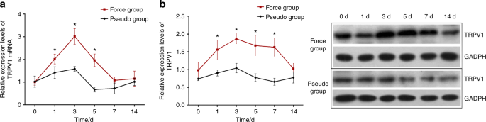 Transient receptor potential vanilloid 1-based gene therapy alleviates orthodontic pain in rats