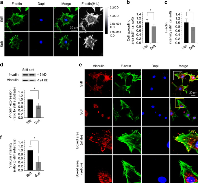 Compliant substratum modulates vinculin expression in focal adhesion  plaques in skeletal cells | International Journal of Oral Science