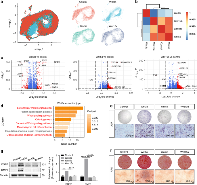 Wnt3a promotes in situ dentin formation through NKD1-MSX1 axis-mediated odontogenic differentiation of dental pulp stem cells - International Journal of Oral Science
