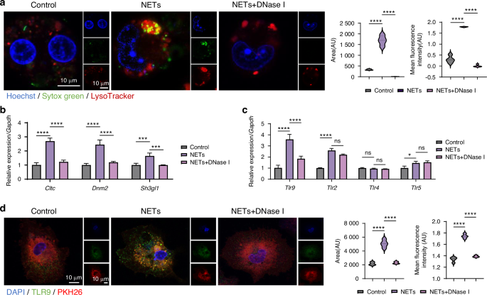 TLR9-engineered photoresponsive biomimetic nanodecoys for focused NETs clearance to mitigate periodontitis-associated bone resorption