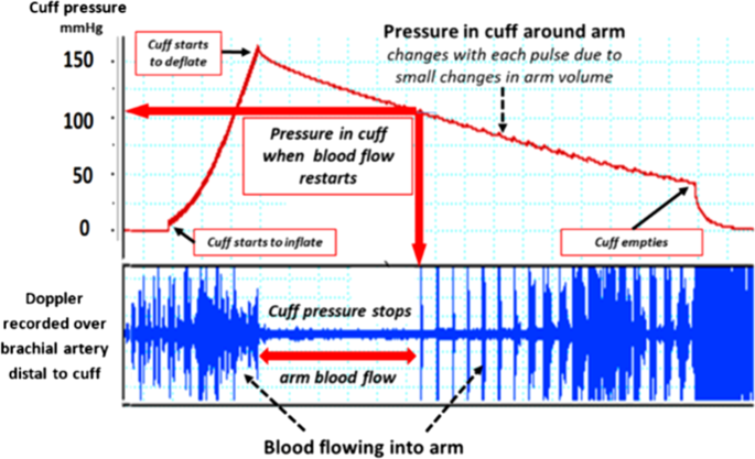 Oscillometric measurement of blood pressure: a simplified