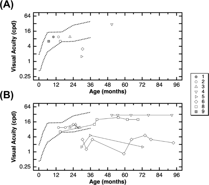 Visual Outcomes In Children With Neonatal Hypoxic Ischemic Encephalopathy Treated With Therapeutic Hypothermia Journal Of Perinatology