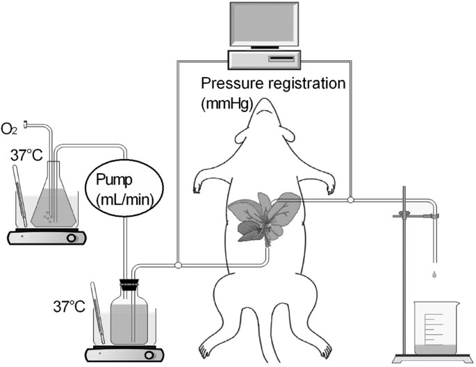 Severe Steatosis Induces Portal Hypertension By Systemic Arterial Hyporeactivity And Hepatic Vasoconstrictor Hyperreactivity In Rats Laboratory Investigation