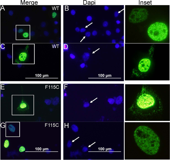 N Terminal Sequences In Matrin 3 Mediate Phase Separation Into Droplet Like Structures That Recruit Tdp43 Variants Lacking Rna Binding Elements Laboratory Investigation