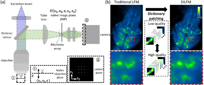 Dilfm: an artifact-suppressed and noise-robust light-field microscopy through dictionary learning