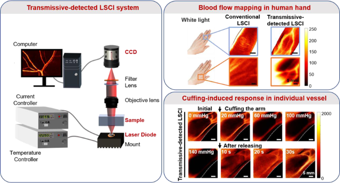 Transmissive-detected laser speckle contrast imaging for blood flow  monitoring in thick tissue: from Monte Carlo simulation to experimental  demonstration | Light: Science & Applications