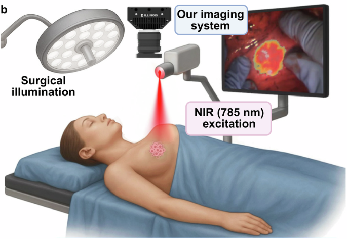 Single-chip, dual-gain color-NIR camera for fluorescence-guided lung and breast cancer surgery - Light: Science &amp; Applications