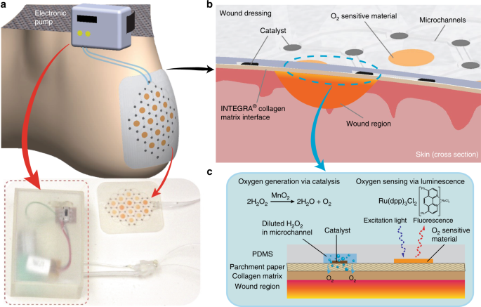 PDF] Repair of cutaneous wounds with the use of low cost surgical glue.