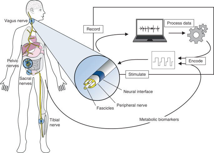 Wireless floating microelectrode array (WFMA) used in this study.