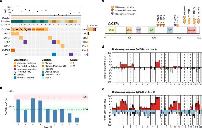 Clinicopathologic And Molecular Analysis Of Embryonal Rhabdomyosarcoma Of The Genitourinary Tract Evidence For A Distinct Dicer1 Associated Subgroup Modern Pathology