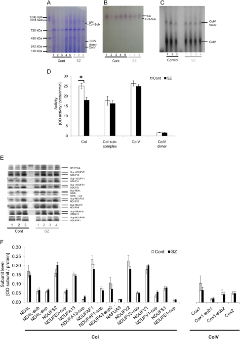 NDUFV2 pseudogene (NDUFV2P1) contributes to mitochondrial complex I deficits in schizophrenia