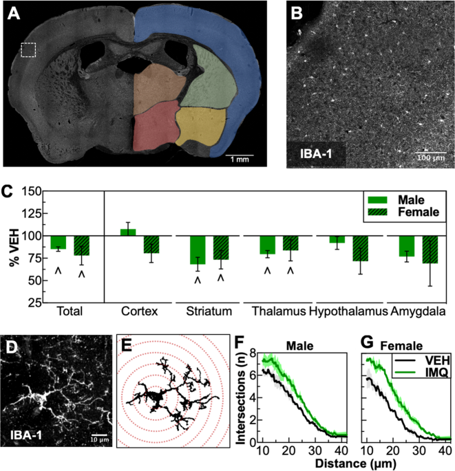 Prenatal Infection May Alter Behavior >> Sex Dependent Neurobiological Features Of Prenatal Immune Activation Prenatal Infection May Alter Behavior >> Sex Dependent Neurobiological Features Of Prenatal Immune Activation