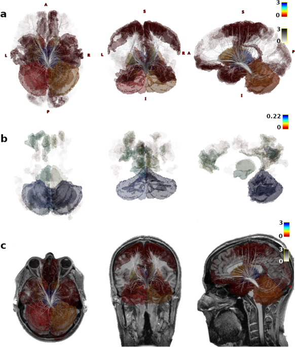 In vivo tractography of human locus coeruleus—relation to 7T resting state fMRI, psychological measures and single subject validity | Molecular Psychiatry - Nature.com