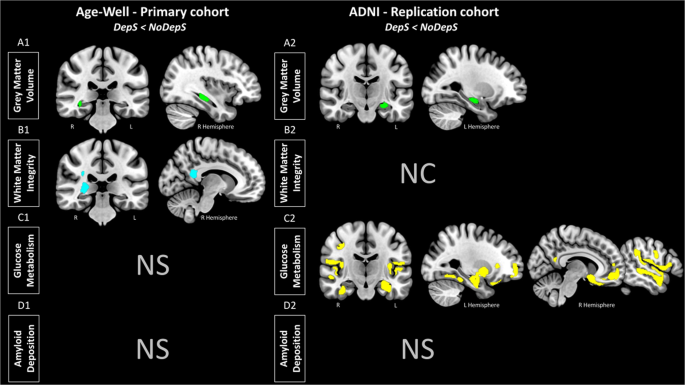 Depressive symptoms in cognitively unimpaired older adults are associated with lower structural and functional integrity in a frontolimbic network | Molecular Psychiatry
