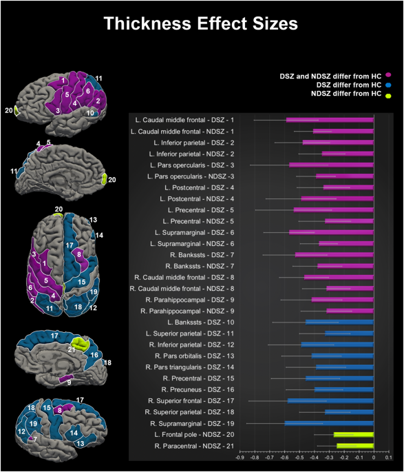 Cortical morphology in patients with the deficit and non-deficit ...