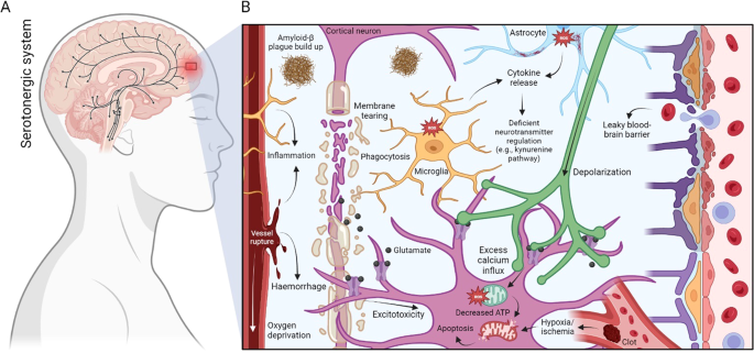 why reduced glutathione Full article: The central role of glutathione in the pathophysiology of  human diseases