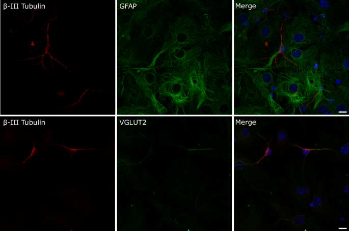 Maternal immune activation imprints translational dysregulation and ...