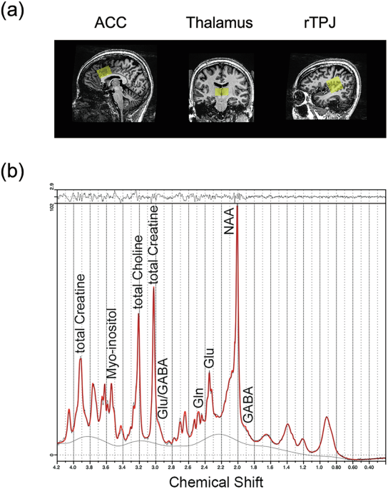 Elevated brain glutamine levels in adults with autism spectrum disorder: A  7T MRS study | Molecular Psychiatry