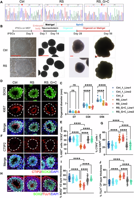 Disrupted PQBP1-HNRNPU-LINE-1 axis underlies aberrant neurodevelopment in renpenning syndrome